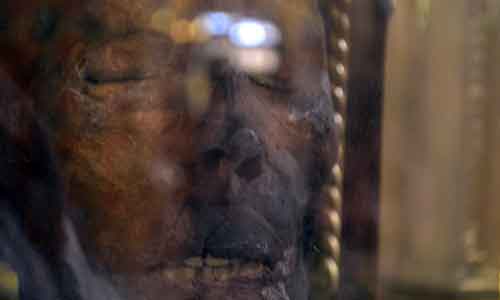 See St Oliver Plunkett's Decapitated Head 1