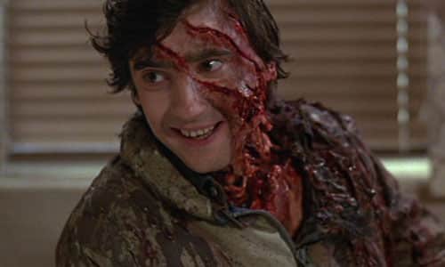 Jack (Griffin Dunne) visits Jack in hospital in An American Werewolf in London 1981