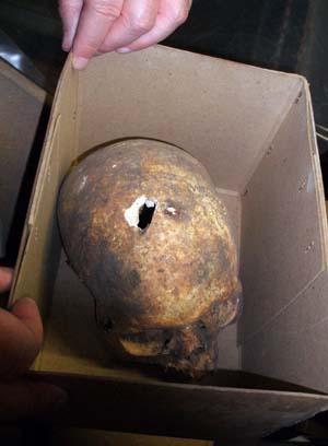 St Brides Skull with Bullet Hole