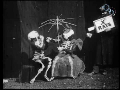 The X-Rays 1897 VIDEO 1 X-Rays