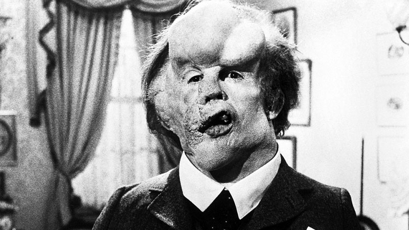 John Hurt as Joseph Merrick, incorrectly called John Merrick, in the film The Elephant Man