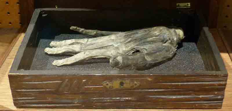 The Hand of Glory in the Whitby Museum - the only one thought to exist.