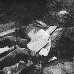 Two Doctors and the Human Candle: A Case of Spontaneous Human Combustion? 2