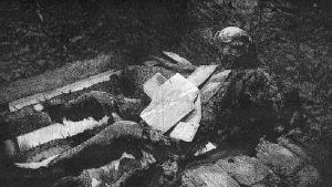 Two Doctors and the Human Candle: A Case of Spontaneous Human Combustion? 2