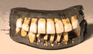 5 Strange Victorian Deaths That'll Make You Laugh and Cry 2